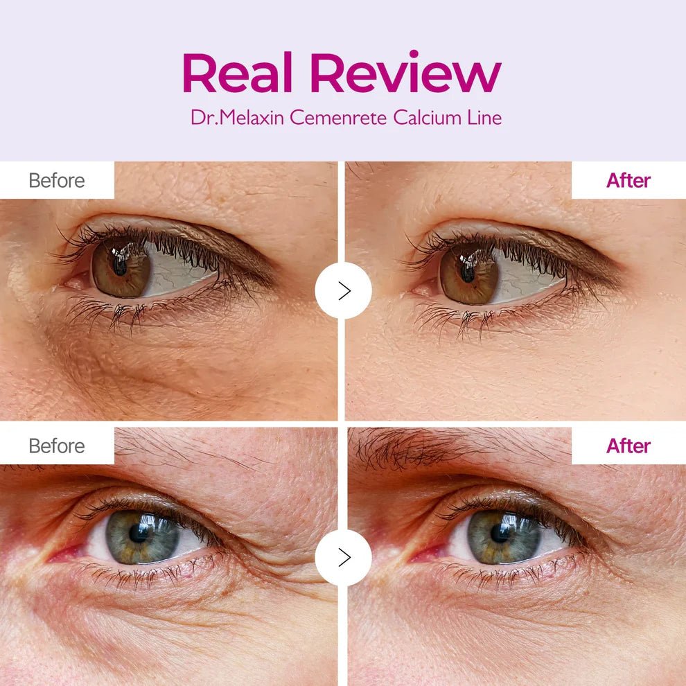 Cemenrete Calcium Volume Eye patch 60ea - Elesar Store